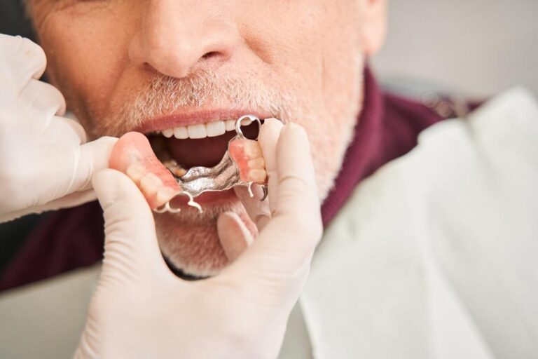 Caring for Your Dentures